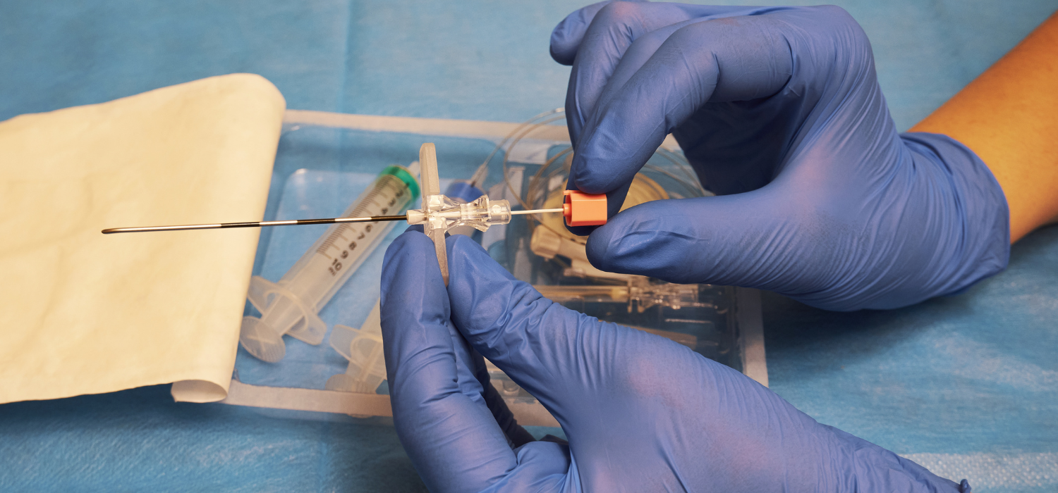 Epidural ambulatoria