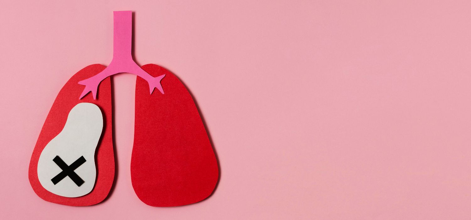 fibrosis pulmonar