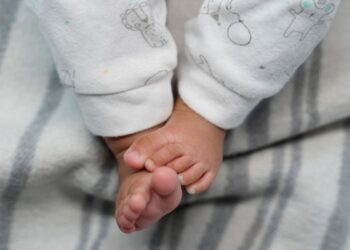 Muere de sarampión una bebé de 6 semanas: Estados Unidos