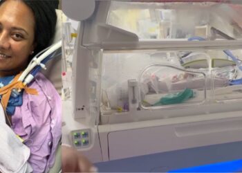 Nació a las 21 semanas y pesó 351 gramos: Miracle ya está en casa
