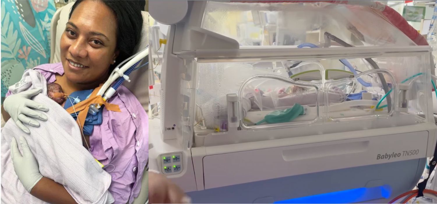 bebé prematura de 21 semanas