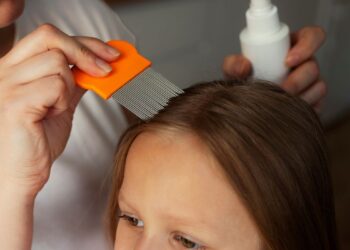 Regresó con piojos de la escuela: ¿cómo quitarlos?