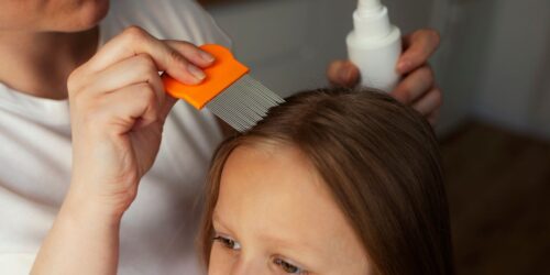 Regresó con piojos de la escuela: ¿cómo quitarlos?
