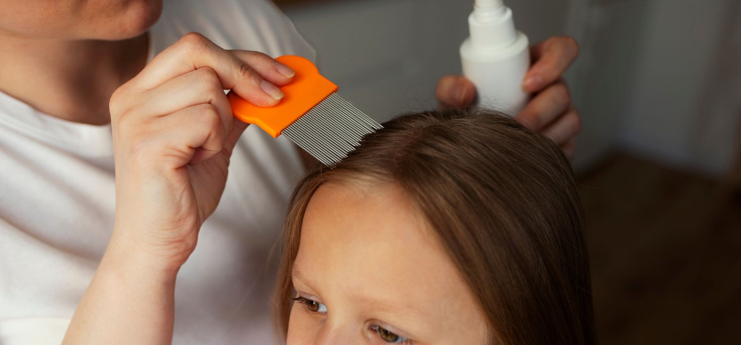 Regresó con piojos de la escuela: ¿cómo quitarlos?