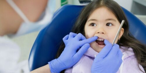 Cómo sobrevivir al dentista cuando tu hijo ODIA el ruido